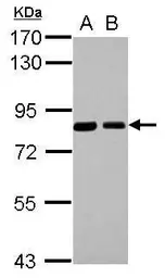 Anti-SNX9 antibody used in Western Blot (WB). GTX103383