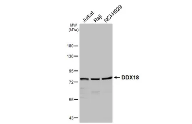 Anti-DDX18 antibody used in Western Blot (WB). GTX103392