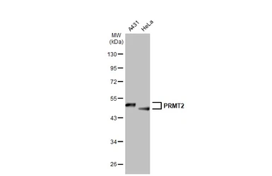 Anti-PRMT2 antibody used in Western Blot (WB). GTX103398
