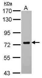 Anti-SAMHD1 antibody used in Western Blot (WB). GTX103400