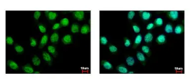 Anti-BS69 antibody used in Immunocytochemistry/ Immunofluorescence (ICC/IF). GTX103403