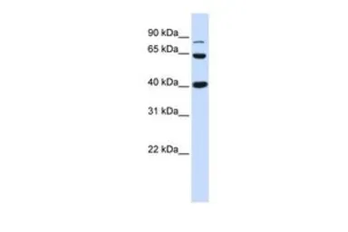 Anti-beta Catenin antibody, Internal used in Western Blot (WB). GTX10342