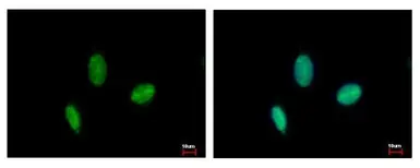 Anti-RAD23B antibody used in Immunocytochemistry/ Immunofluorescence (ICC/IF). GTX103424