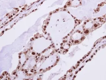 Anti-RAD23B antibody used in IHC (Paraffin sections) (IHC-P). GTX103424