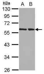 Anti-RAD23B antibody used in Western Blot (WB). GTX103424