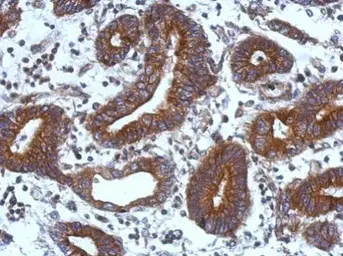Anti-TIE1 antibody used in IHC (Paraffin sections) (IHC-P). GTX103429