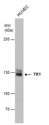 Anti-TIE1 antibody used in Western Blot (WB). GTX103429