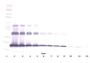 Anti-sRANKL antibody used in Western Blot (WB). GTX10343