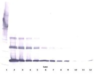 Anti-sRANKL antibody used in Western Blot (WB). GTX10343