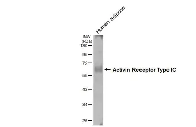 Anti-Activin Receptor Type IC antibody used in Western Blot (WB). GTX103442