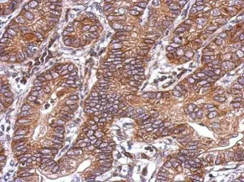Anti-Activin Receptor Type IC antibody used in IHC (Paraffin sections) (IHC-P). GTX103442