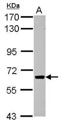 Anti-Activin Receptor Type IC antibody used in Western Blot (WB). GTX103442