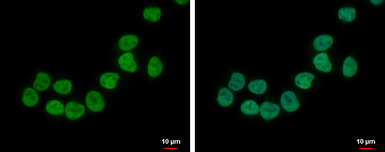 Anti-ZNF45 antibody [N2C3] used in Immunocytochemistry/ Immunofluorescence (ICC/IF). GTX103451