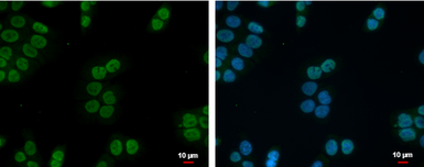 Anti-ZNF45 antibody [N2C3] used in Immunocytochemistry/ Immunofluorescence (ICC/IF). GTX103451