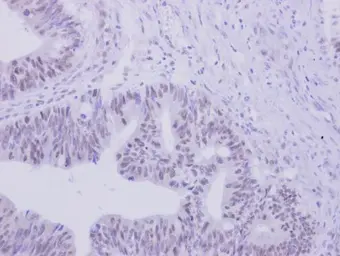 Anti-ZNF45 antibody [N2C3] used in IHC (Paraffin sections) (IHC-P). GTX103451