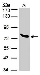 Anti-ZNF45 antibody [N2C3] used in Western Blot (WB). GTX103451