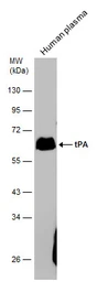 Anti-tPA antibody used in Western Blot (WB). GTX103453