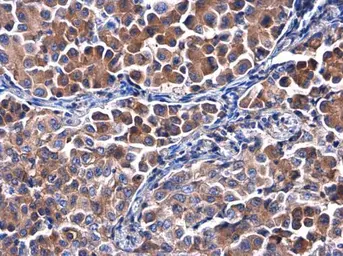 Anti-Calpastatin antibody used in IHC (Paraffin sections) (IHC-P). GTX103454