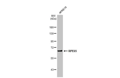 Anti-RPE65 antibody [N1C3] used in Western Blot (WB). GTX103472