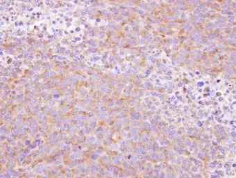 Anti-SCYL3 antibody [N1C3] used in IHC (Paraffin sections) (IHC-P). GTX103501