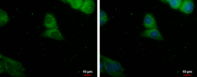 Anti-PDE8A antibody used in Immunocytochemistry/ Immunofluorescence (ICC/IF). GTX103504