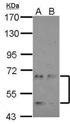 Anti-NKIAMRE antibody [N1C1] used in Western Blot (WB). GTX103512