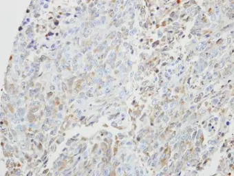Anti-PRKX antibody [N1C3] used in IHC (Paraffin sections) (IHC-P). GTX103515