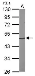Anti-PRKX antibody [N1C3] used in Western Blot (WB). GTX103515
