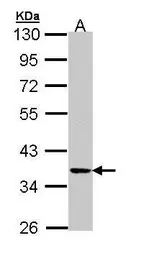 Anti-PRKX antibody [N1C3] used in Western Blot (WB). GTX103515