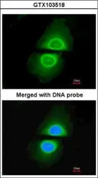 Anti-CYP4A11 antibody [N1C1] used in Immunocytochemistry/ Immunofluorescence (ICC/IF). GTX103518