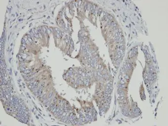 Anti-CYP4A11 antibody [N1C1] used in IHC (Paraffin sections) (IHC-P). GTX103518