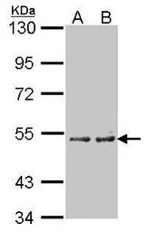 Anti-CYP4A11 antibody [N1C1] used in Western Blot (WB). GTX103518