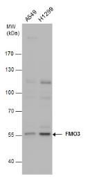 Anti-FMO3 antibody [N2C2], Internal used in Western Blot (WB). GTX103521
