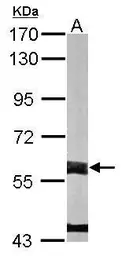 Anti-FMO3 antibody [N2C2], Internal used in Western Blot (WB). GTX103521