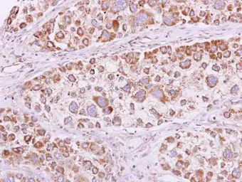 Anti-PSKH1 antibody used in IHC (Paraffin sections) (IHC-P). GTX103525