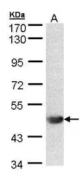 Anti-ALG1 antibody [N1C2] used in Western Blot (WB). GTX103537
