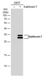 Anti-Kallikrein 7 antibody used in Western Blot (WB). GTX103548