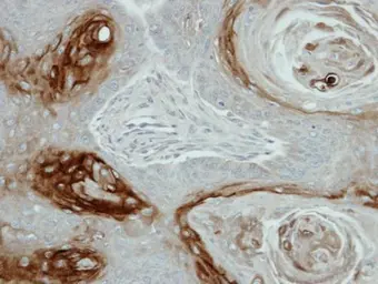 Anti-Kallikrein 7 antibody used in IHC (Paraffin sections) (IHC-P). GTX103548