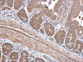 Anti-ECH1 antibody [N1C3] used in IHC (Paraffin sections) (IHC-P). GTX103552