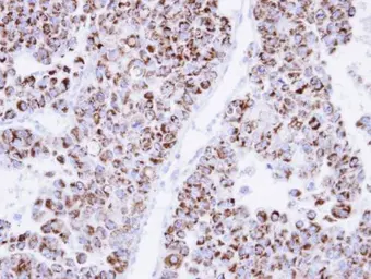 Anti-ECH1 antibody [N1C3] used in IHC (Paraffin sections) (IHC-P). GTX103552