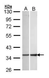 Anti-ECH1 antibody [N1C3] used in Western Blot (WB). GTX103552
