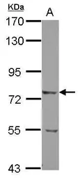 Anti-LRRN2 antibody [N2C2], Internal used in Western Blot (WB). GTX103566