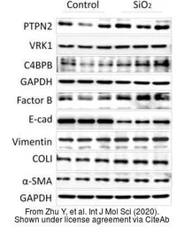 Anti-Factor B antibody [N2C2], Internal used in Western Blot (WB). GTX103570