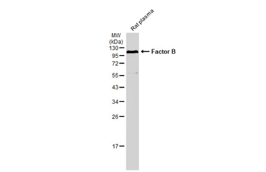 Anti-Factor B antibody [N2C2], Internal used in Western Blot (WB). GTX103570