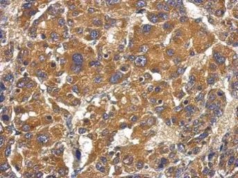 Anti-Factor B antibody [N2C2], Internal used in IHC (Paraffin sections) (IHC-P). GTX103570
