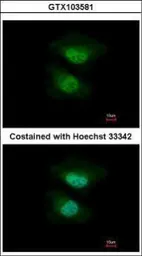 Anti-NAB2 antibody used in Immunocytochemistry/ Immunofluorescence (ICC/IF). GTX103581