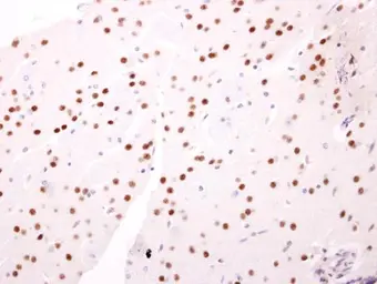 Anti-NAB2 antibody used in IHC (Paraffin sections) (IHC-P). GTX103581