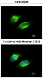 Anti-PAPSS1 antibody [C1C3] used in Immunocytochemistry/ Immunofluorescence (ICC/IF). GTX103608