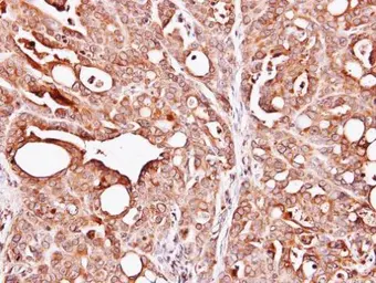 Anti-PAPSS1 antibody [C1C3] used in IHC (Paraffin sections) (IHC-P). GTX103608