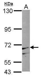 Anti-PAPSS1 antibody [C1C3] used in Western Blot (WB). GTX103608
